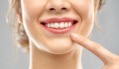 woman pointing to her straight white teeth