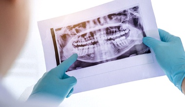 dentist pointing at an X-ray